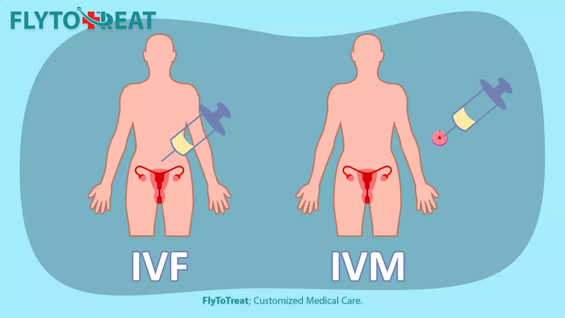 What is IVM?