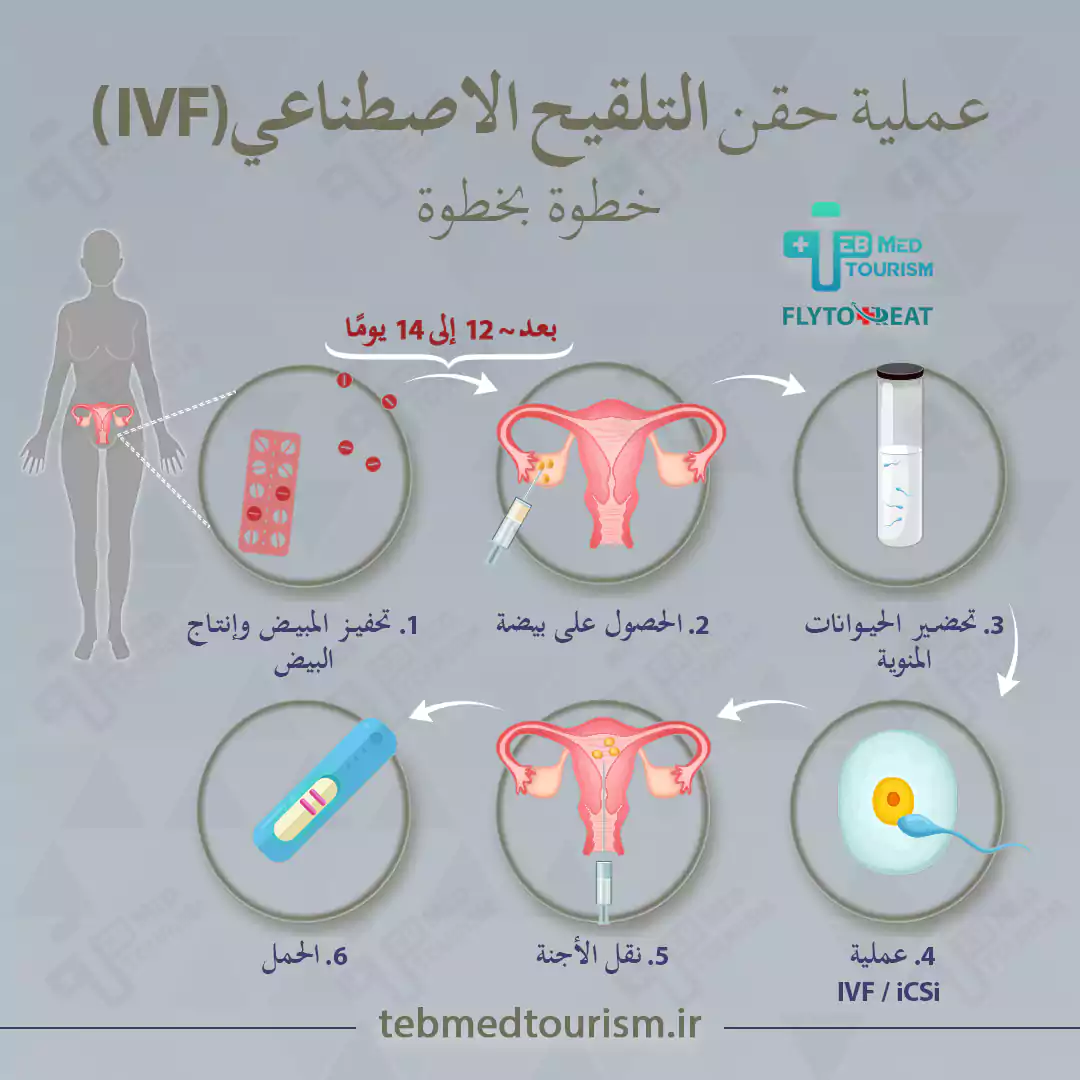 كيف تبدو عملية التلقيح الصناعي (IVF)؟