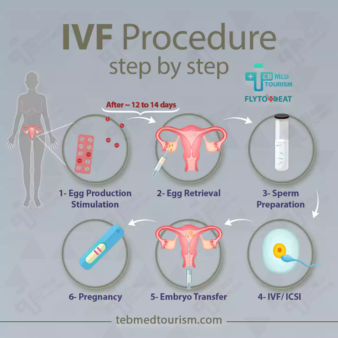 روند IVF در ایران
