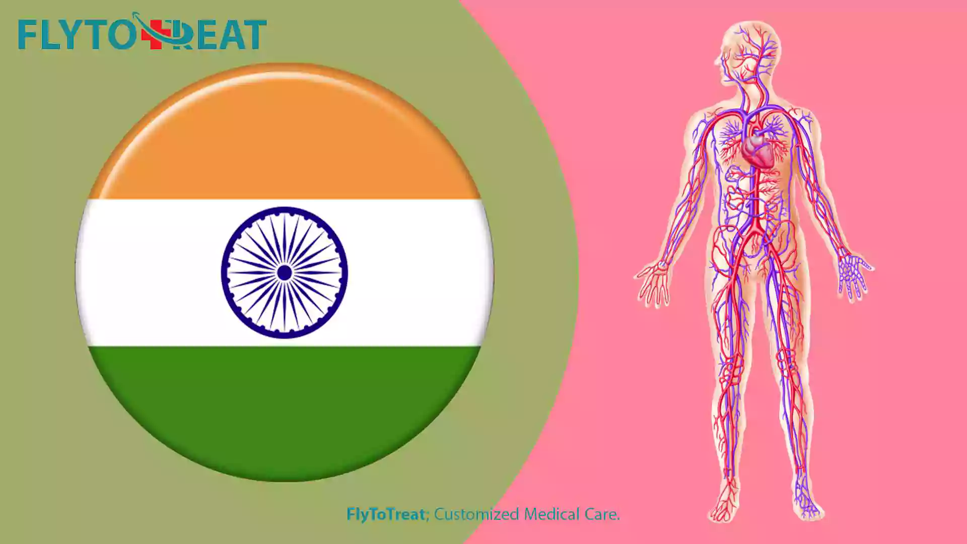 The Best Vessels Angioplasty in India with FlytoTreat