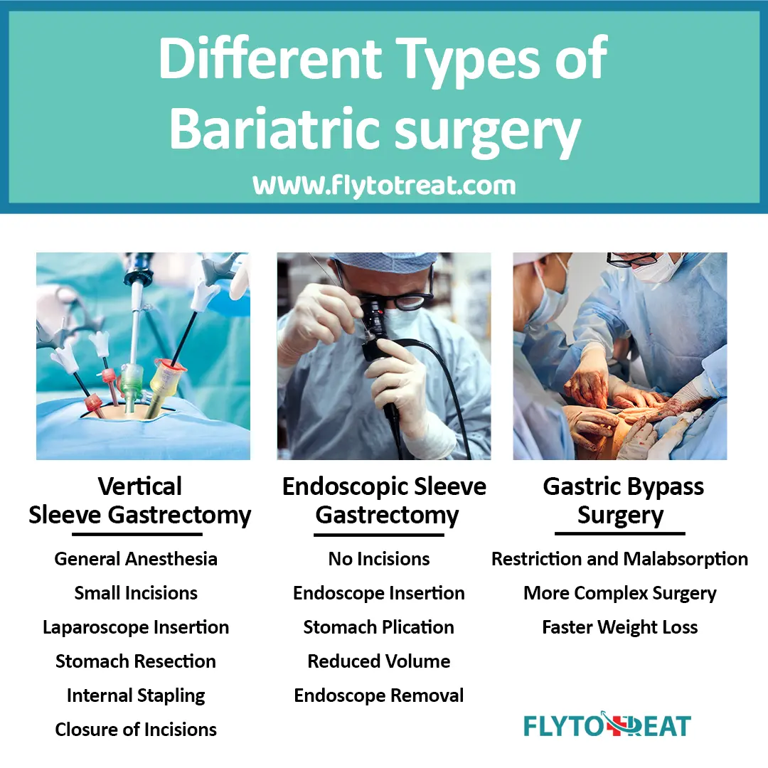 Different types of bariatric surgery