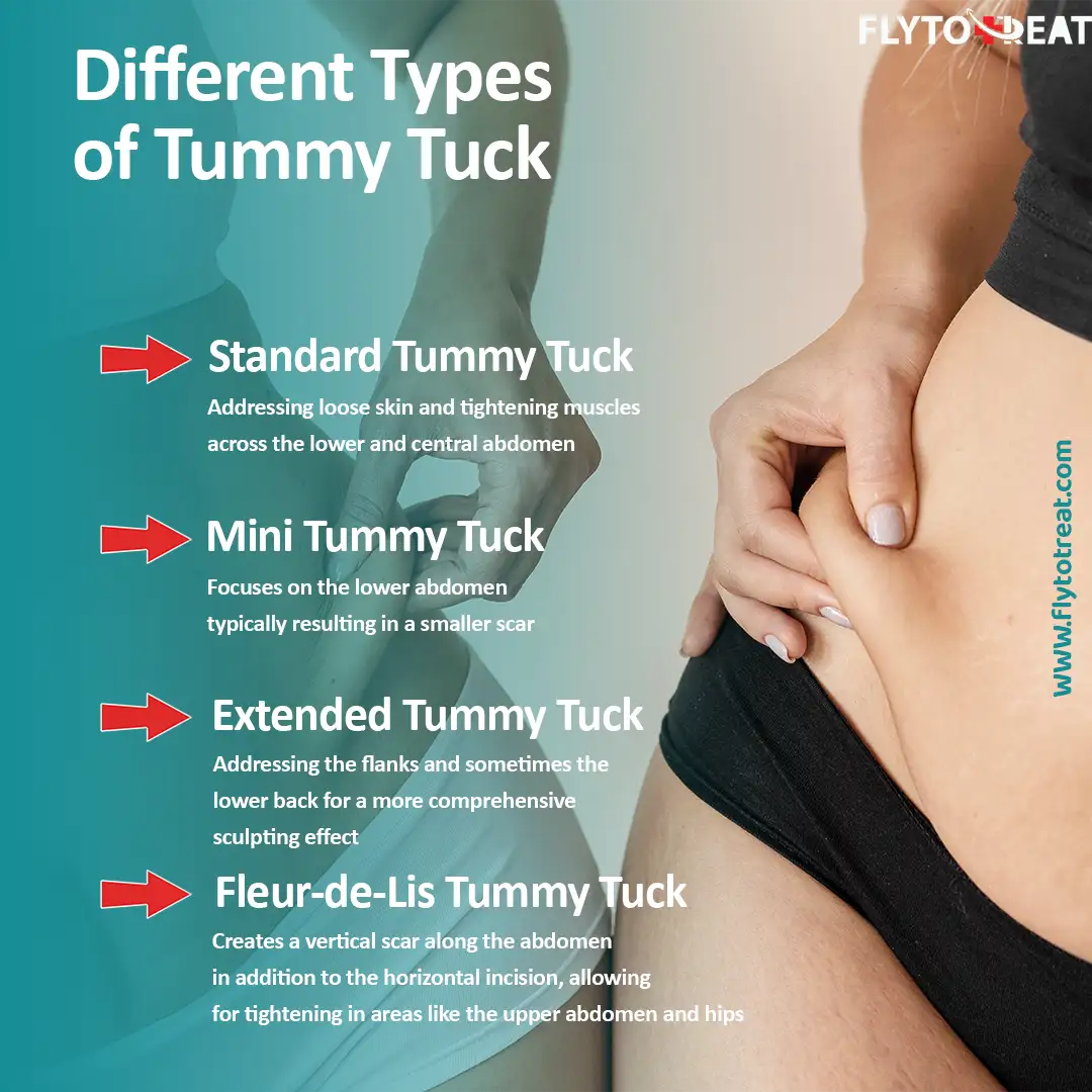 Different types of tummy tuck