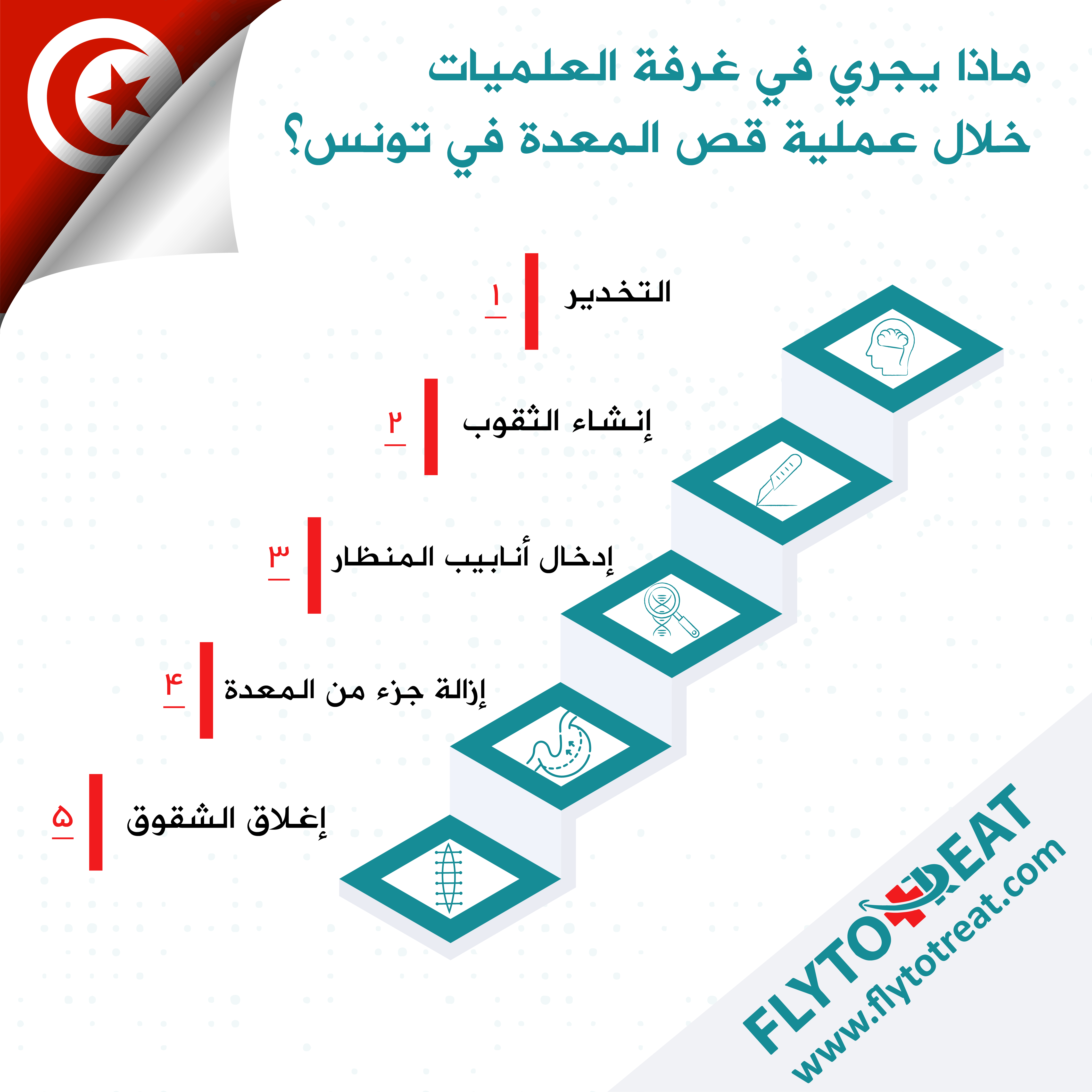 مراحل جراحة تكميم المعدة في غرفة العمليات