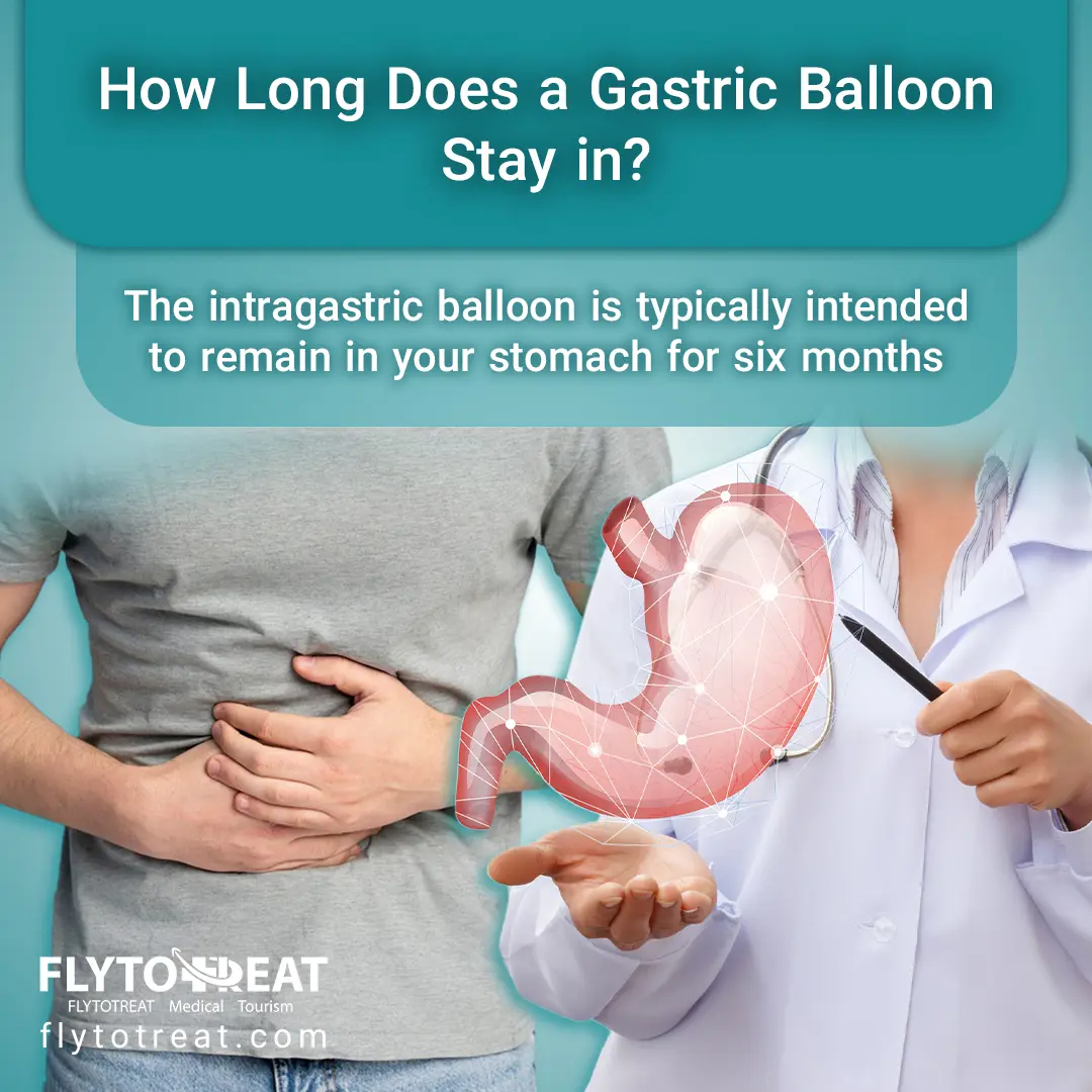 How Long Does a Gastric Balloon Stay in?